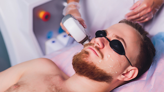 mens laser hair removal