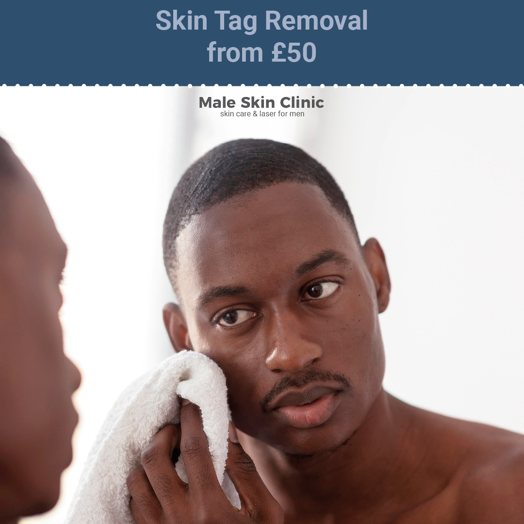 Skin Tag Removal