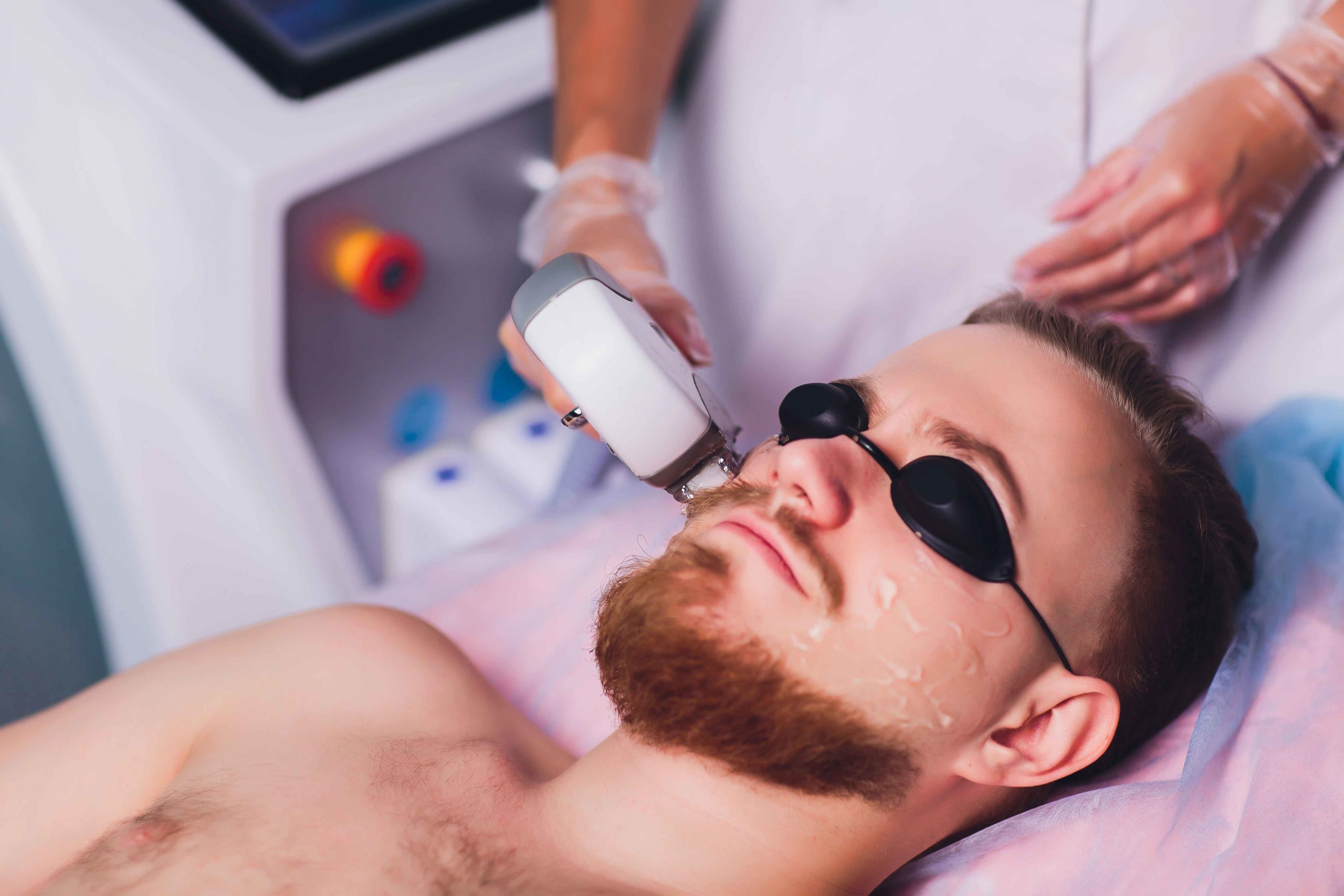 Mens Face Beard Line Laser Hair