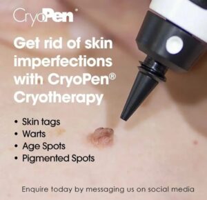 What-can-cryopen-treat-1024x990 Skintag Removal with Cryopen