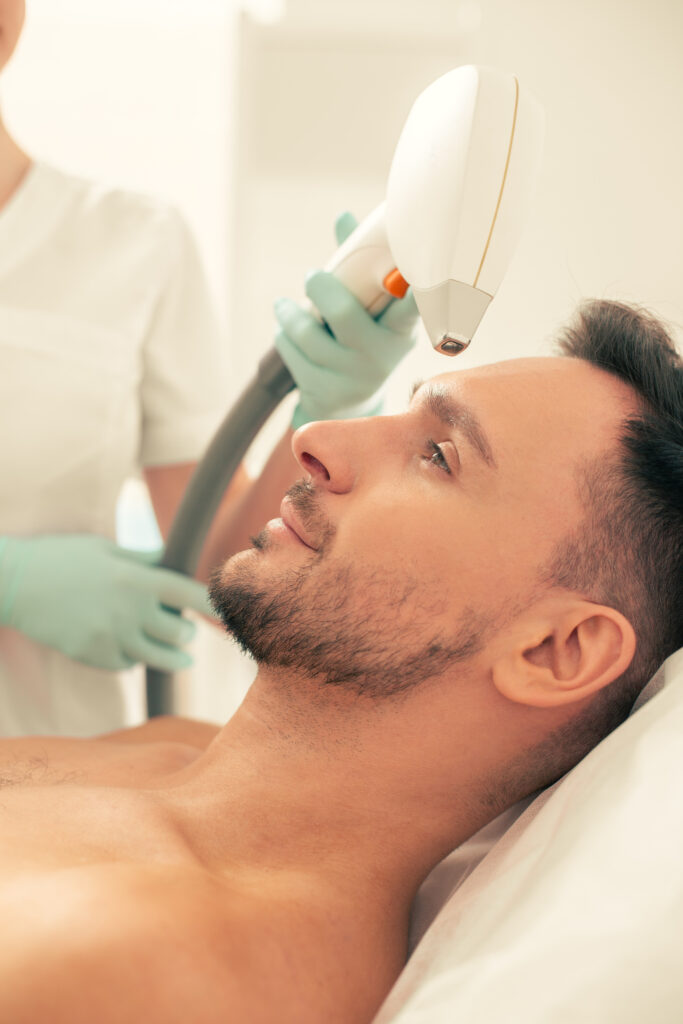 Face Laser Hair Removal For Men face laser hair removal for men